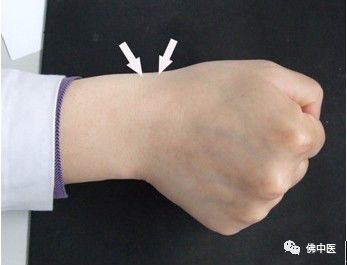 抱孩子怎么预防粗手臂,防止手腕疼的正确抱孩子姿势