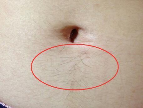 女人腿上长白毛的风水寓意,腿上长毛的女孩有福气吗