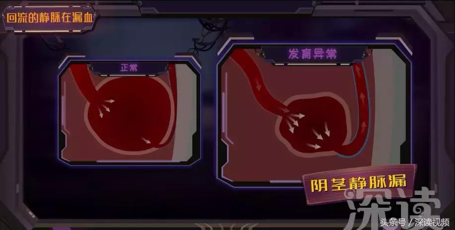 谁让你“兄弟”不给力,谁让你“痿”靡不振?阳痿真凶都在这啦!