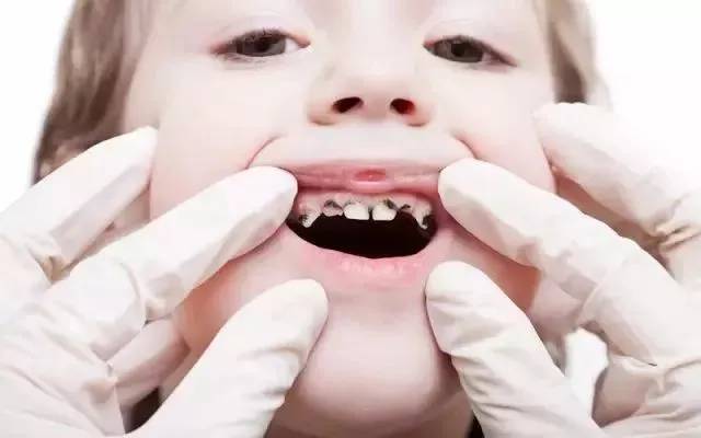 牙膏测评高露洁防蛀牙膏,牙膏推荐测评云南白药朗健