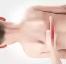 宝宝湿疹和痱子可不一样,这个方法学会了,对付湿疹最好了!