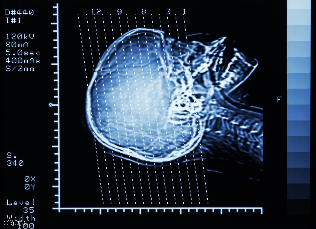医生提醒看远处保护视力,医生眼里的眩晕是什么感觉