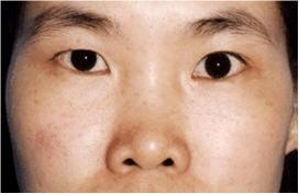 面相几种鼻型的图片,面相鼻子的几种类型图解