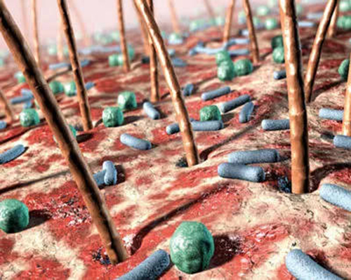 头皮顽固毛囊炎用什么洗头膏,头皮毛囊炎的症状和图片