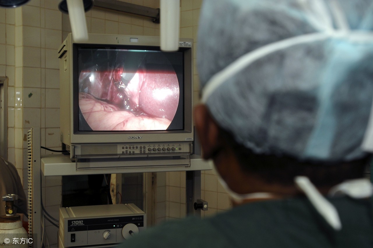 做胃镜有多可怕,做胃镜肠镜那么可怕吗