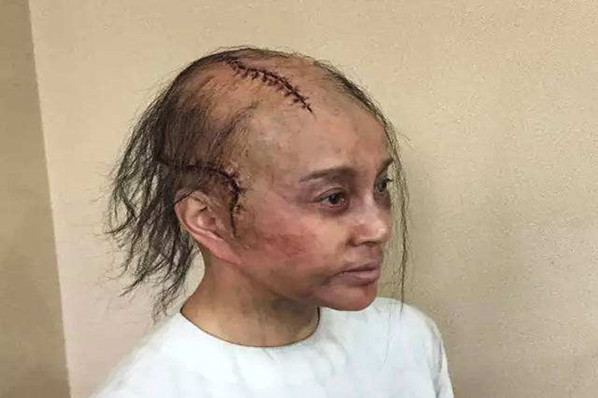 光头挑战榜前十名,十大女星光头