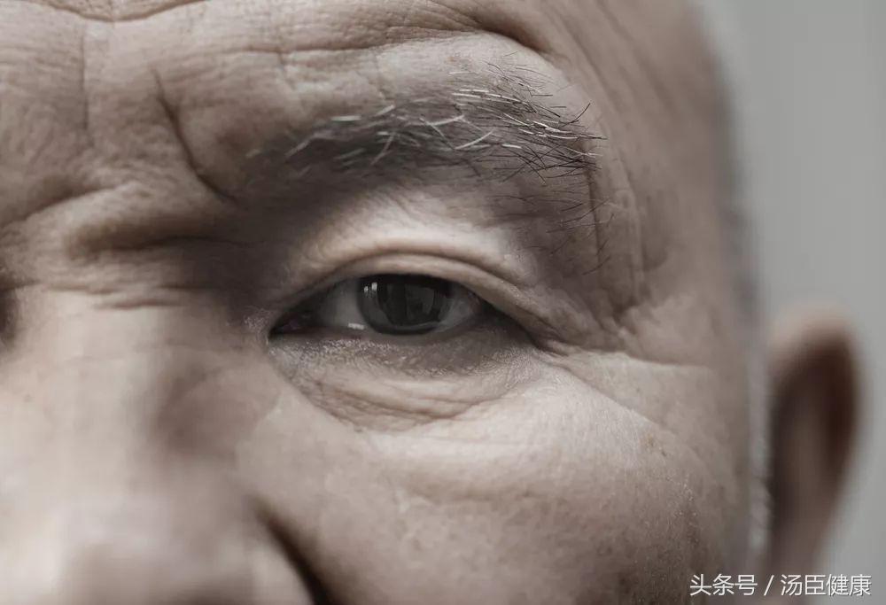 什么样的眉毛是杂乱眉,眉毛非常稀疏适合雾眉还是线条眉