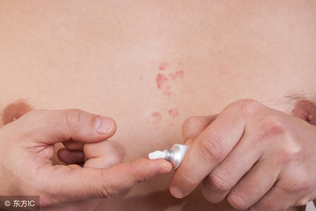 婴儿湿疹怎么按摩能治好,宝宝湿疹按哪个穴位最好