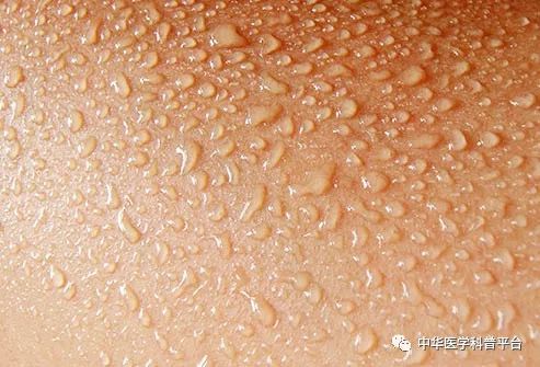 炎热的天气对身体伤害大吗,炎热的天气带来了什么危害