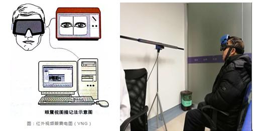 位置性眩晕眼震,眼震检查临床意义