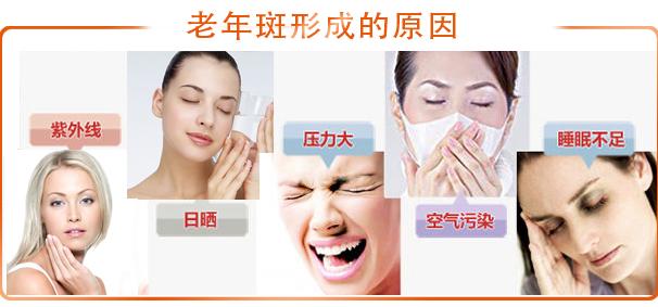老年斑的最佳消除方法,老年斑不容易去除的原因