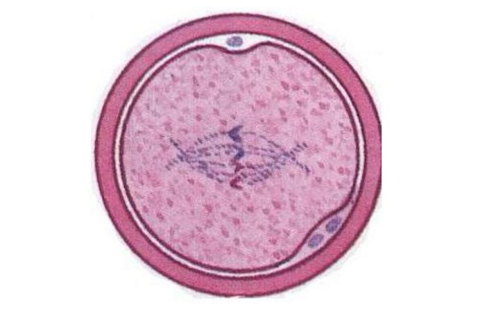 孕期见红要当心先兆流产,孕期出血一定就是先兆流产吗