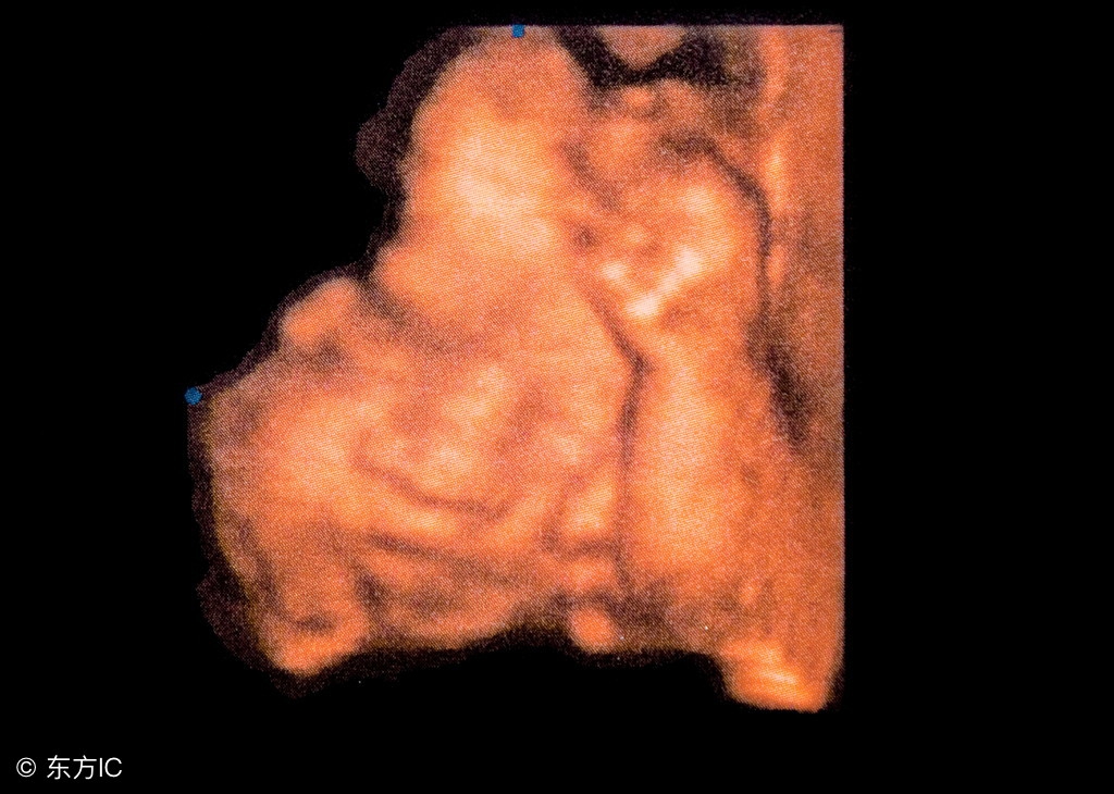 孕晚期能听见宝宝的动静吗,孕晚期的宝宝能听懂妈妈说的话吗