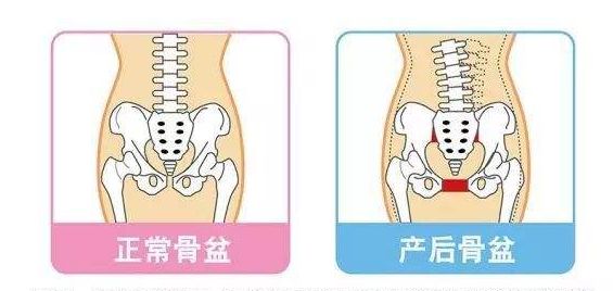 产后妈妈恢复第二课盆底肌修复,二胎妈妈沙龙
