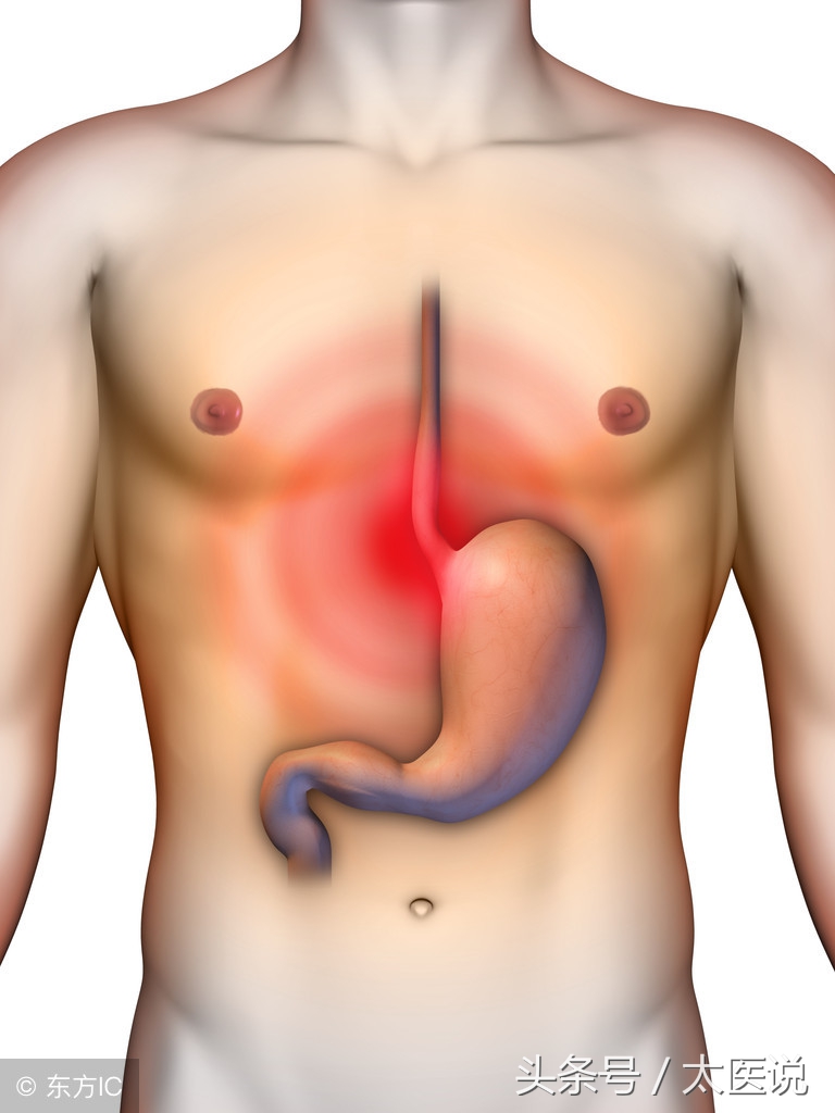 肥胖糖尿病减重手术有哪几种,减重手术减重的原理