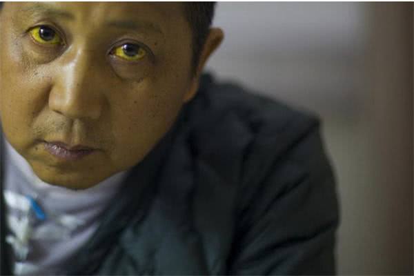 乔布斯死于癌细胞的征兆,乔布斯癌症早期症状