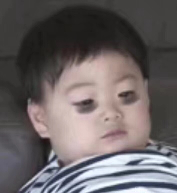 改善肿眼的眼霜,消除眼细纹眼霜