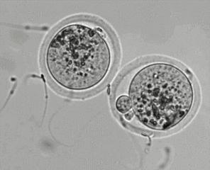 一颗精子两颗卵子受孕,一颗精子和卵子相遇过程