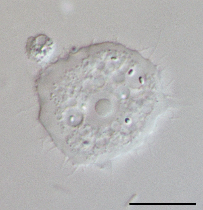 感染食脑虫的人,感染食脑虫的动物