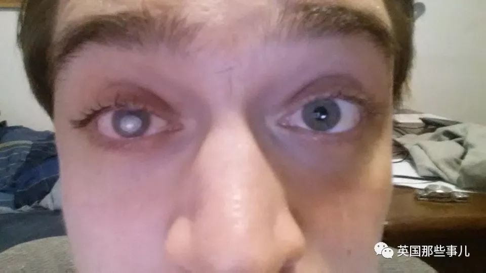 戴着隐形眼镜洗了一次澡,戴了隐形眼镜晚上还是看不清楚