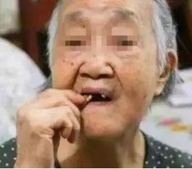 牙齿矫正8月最新价格,2024年30岁牙齿矫正费用多少钱