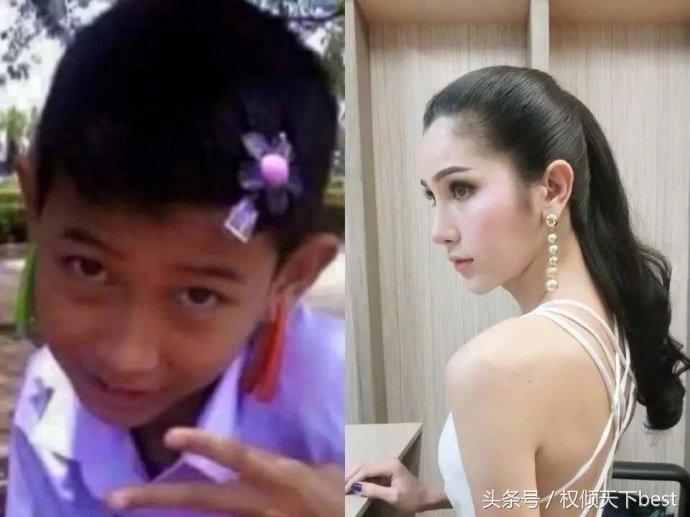 泰国人变性术前后对比,泰国的变性手术是什么原理