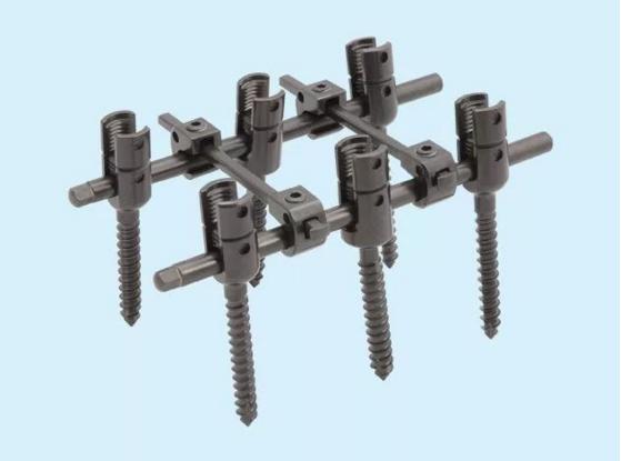 脊柱手术打入4个钉子多久能活动,脊柱手术打19个钢钉