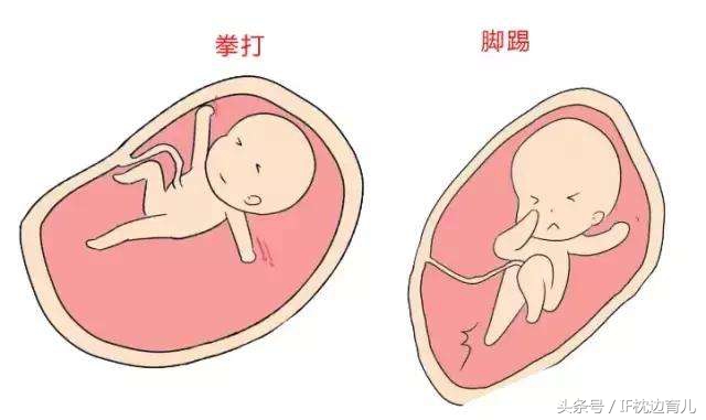 22周胎动频繁和性格有关系吗,神经管缺陷胎儿胎动会很频繁吗
