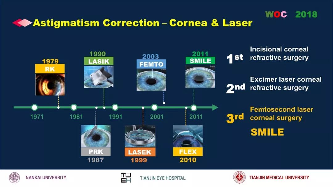 散光治疗技术突破,散光的矫正