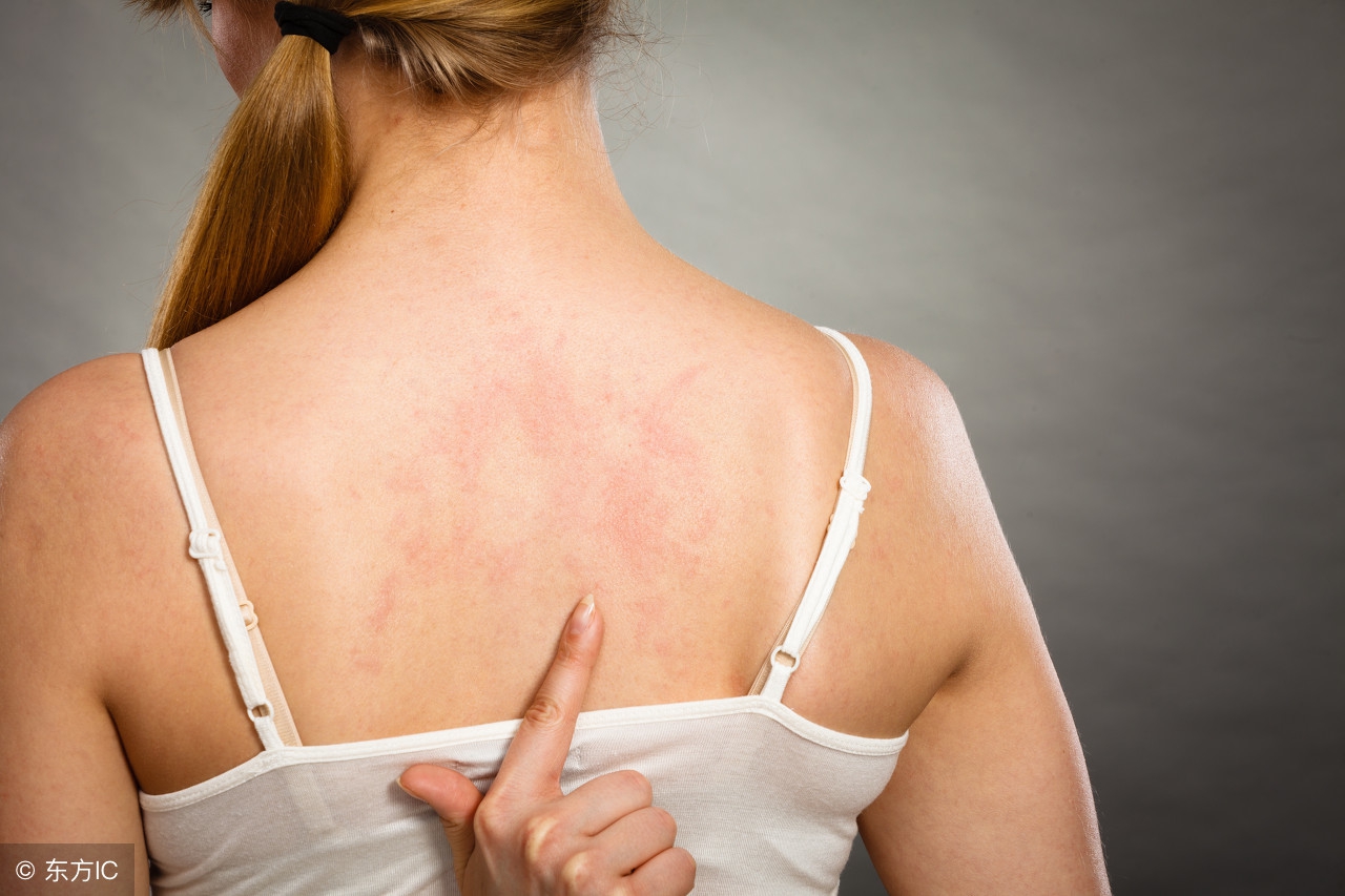 怎样拍好一张患处照片，才能方便网上的医生帮我看病？