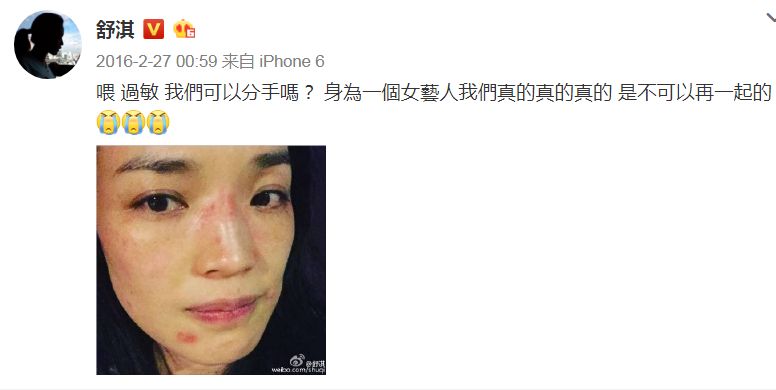 每天8杯水喝到眼瞎,每天8杯水皮肤会怎么样