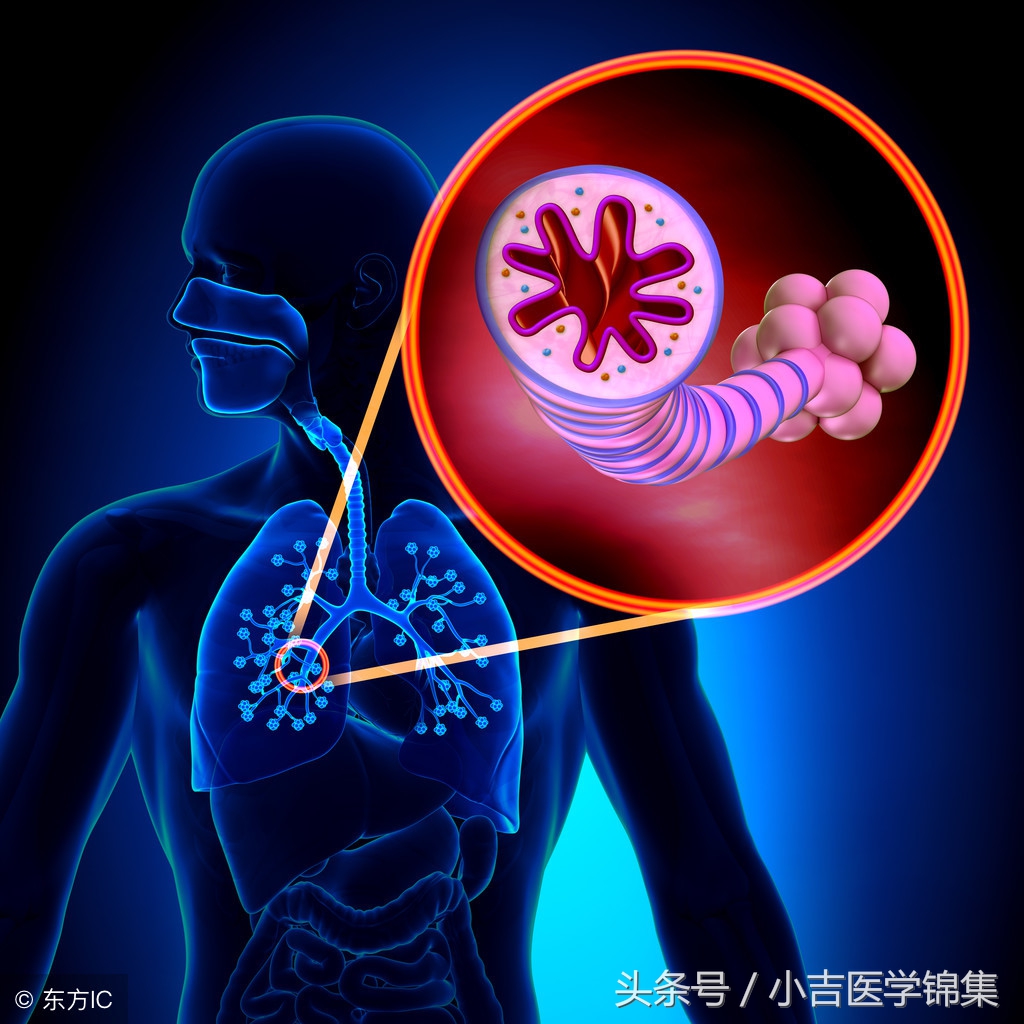 支气管扩张能治断根吗,支气管扩张剂