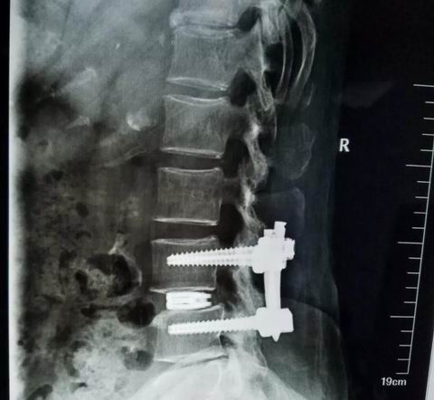 安阳市安钢总医院骨科专家,安钢医院脊柱微创中心主任名单