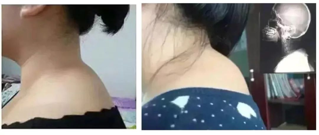 天鹅颈锁骨怎么练快速明显,天鹅颈的修炼方法视频