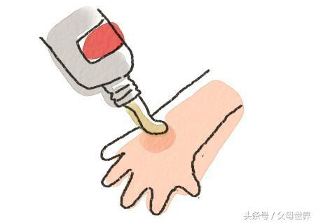 孩子烫伤第一时间怎么处理,孩子烫伤恢复过程