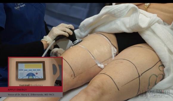 躺着不动就减肥的神器,胖子减肥有一种特效药