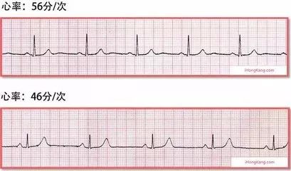 讲的好，记得牢！这可能是我见过最高效的“药理学”学习法啦！