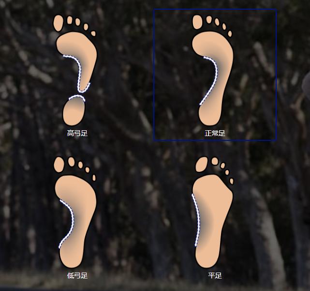 咕咚厚底跑鞋测评,299超轻软底跑鞋