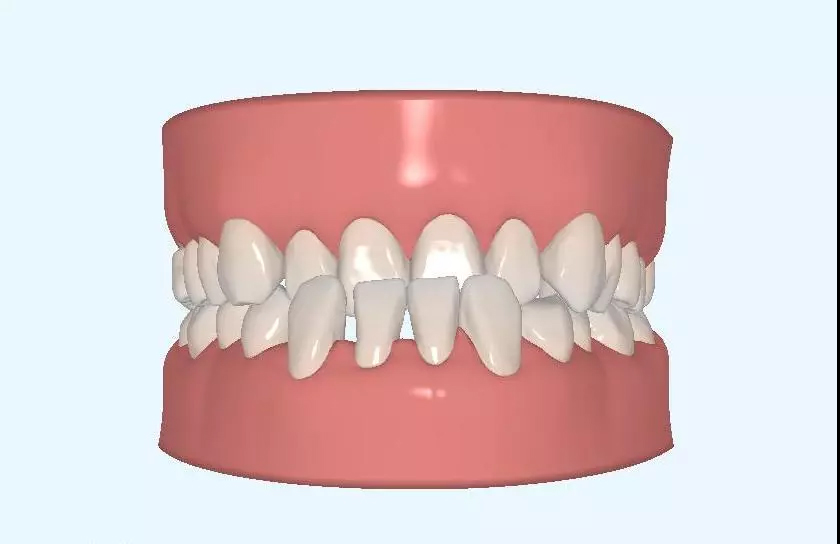 超实用的拔牙小技巧有哪些,拔牙知识图片