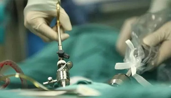 八个细节助你远离食管癌,哪些人要警惕食管癌