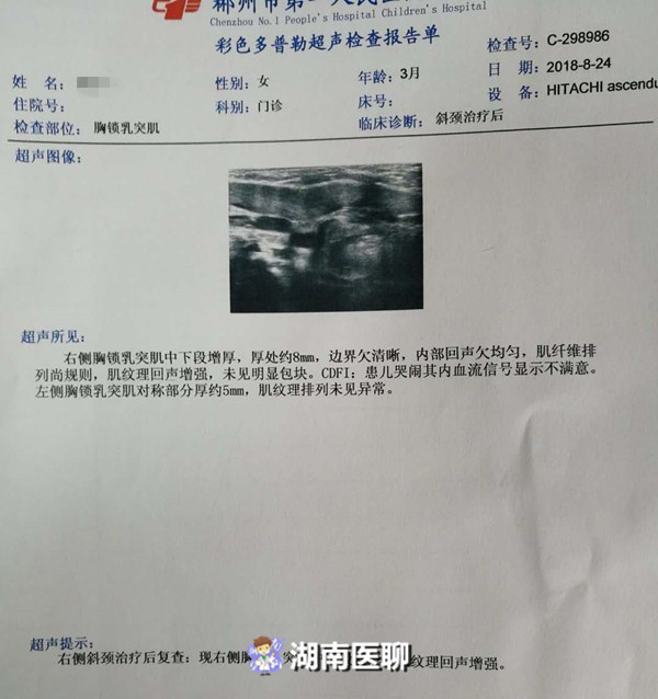 一岁宝宝胸骨突出,1岁宝宝一边肋骨突出是怎么回事