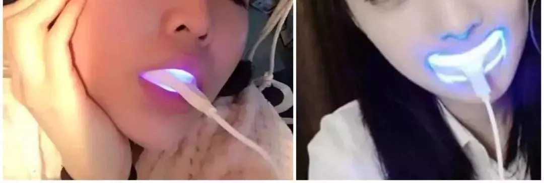 蓝光美白牙仪真的管用吗,美牙仪冷光美白原理