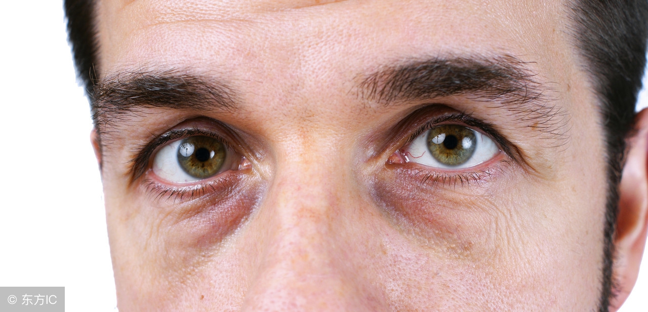 两只眼睛上眼皮浮肿是什么原因,每天睡起来眼睛浮肿是什么原因