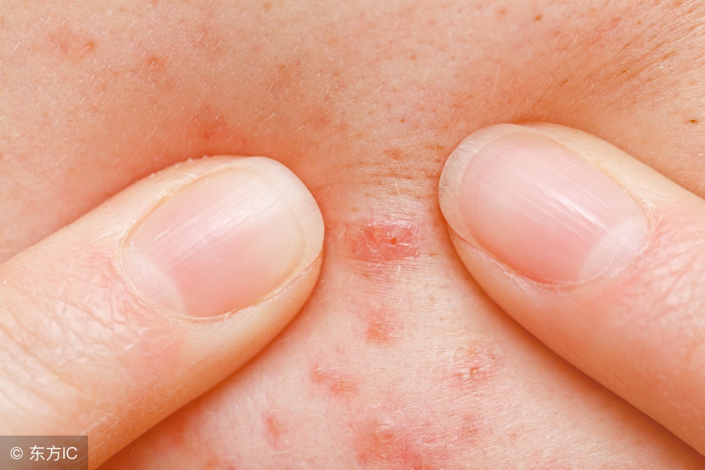 全身频繁长疮是怎么回事,身体多个部位长疮什么原因