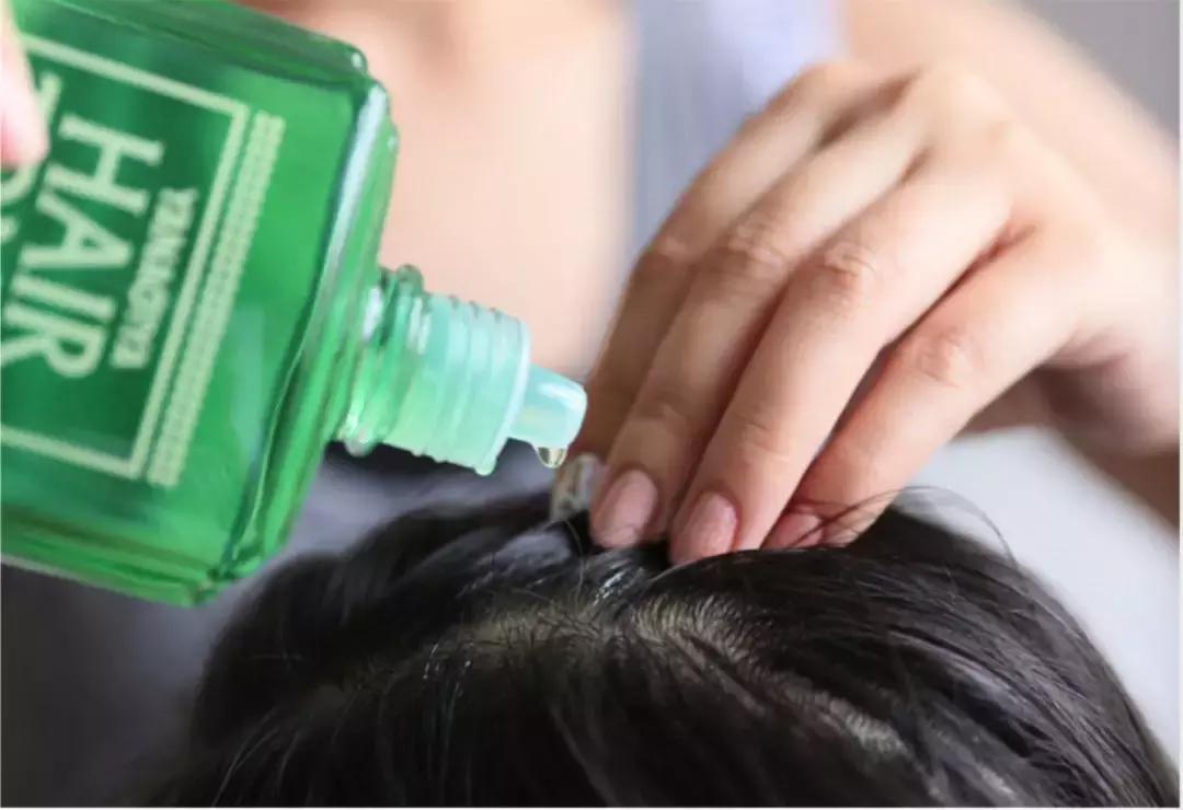 发际线高脱发用什么洗发水,发际线高掉头发洗发水测评