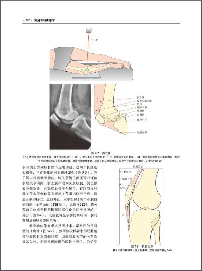 实用骨科影像学——原书第6版经典之作