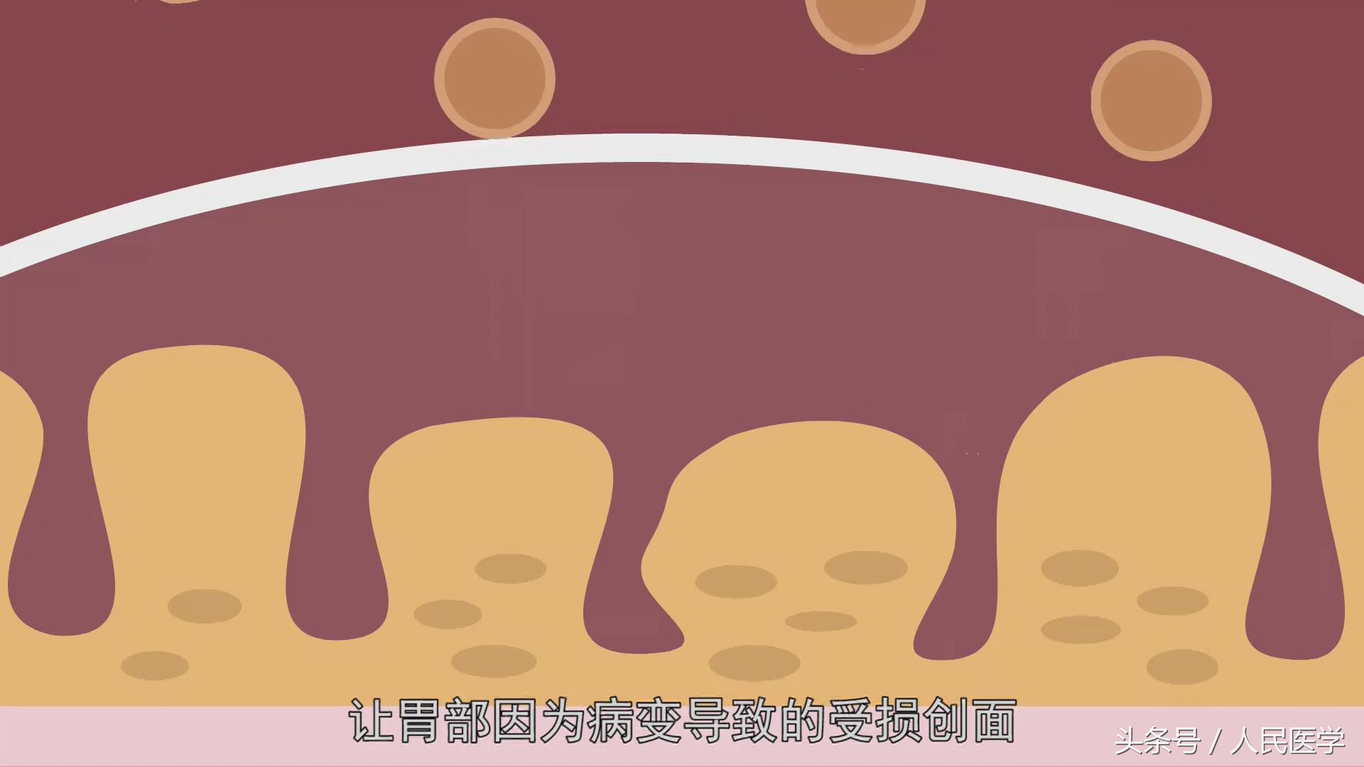 胃不舒服吃达喜就好是什么原因,达喜这种药可以治疗哪些胃病