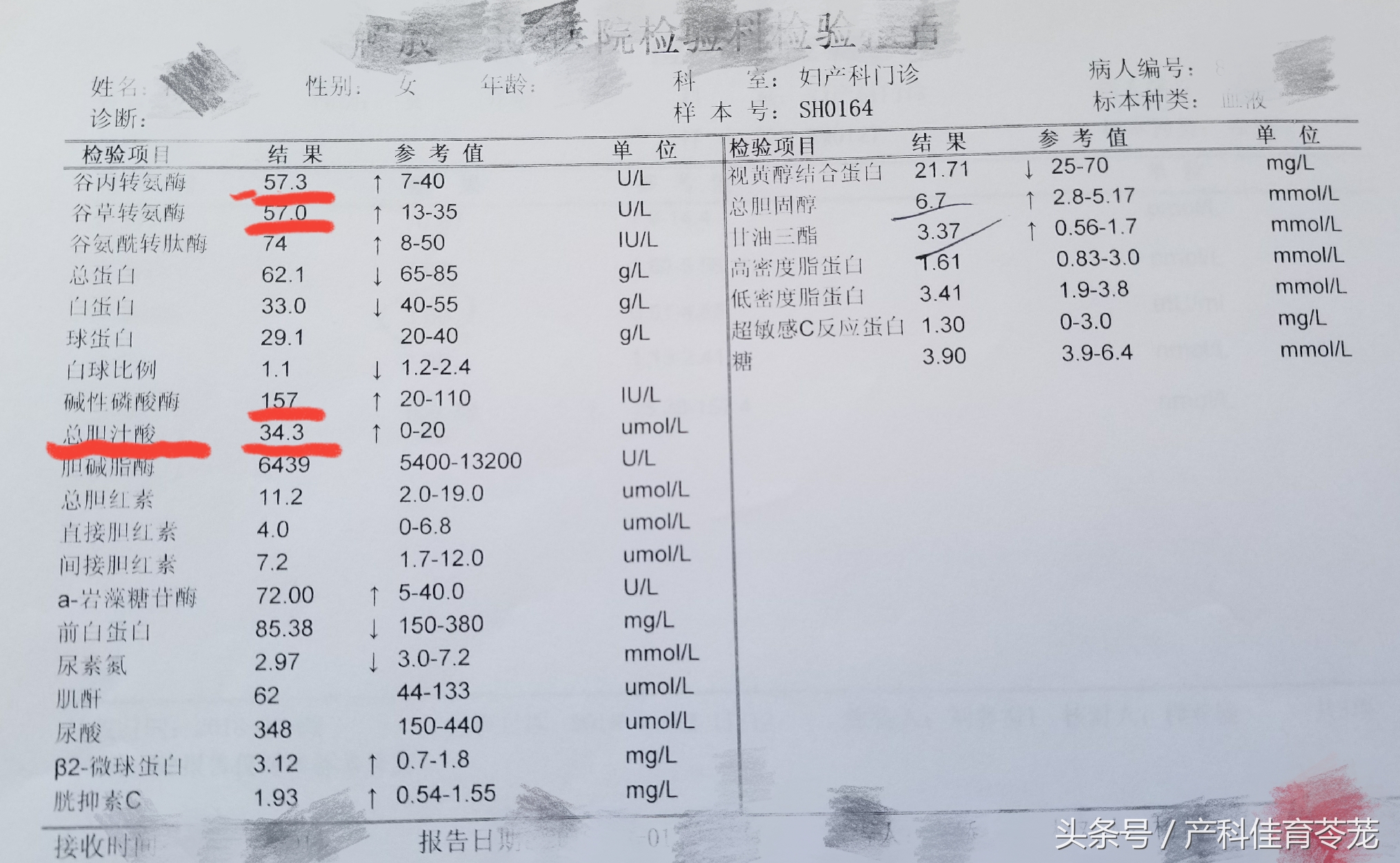 妊娠期肝功能异常是怎么回事,孕期胆汁淤积看肝功哪个指标