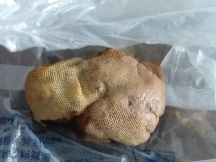 流产手术后有残留,流产手术全程疼痛难忍