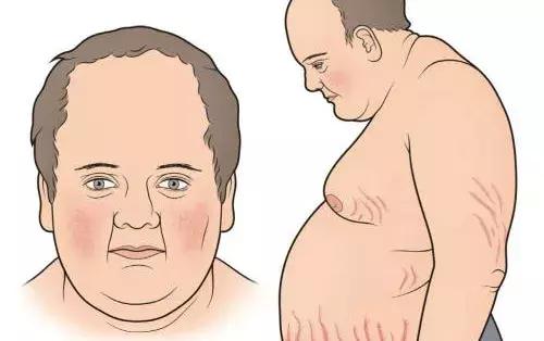 大叔用皮炎平治好了咽炎,老军医给了个咽炎的方子三天见效